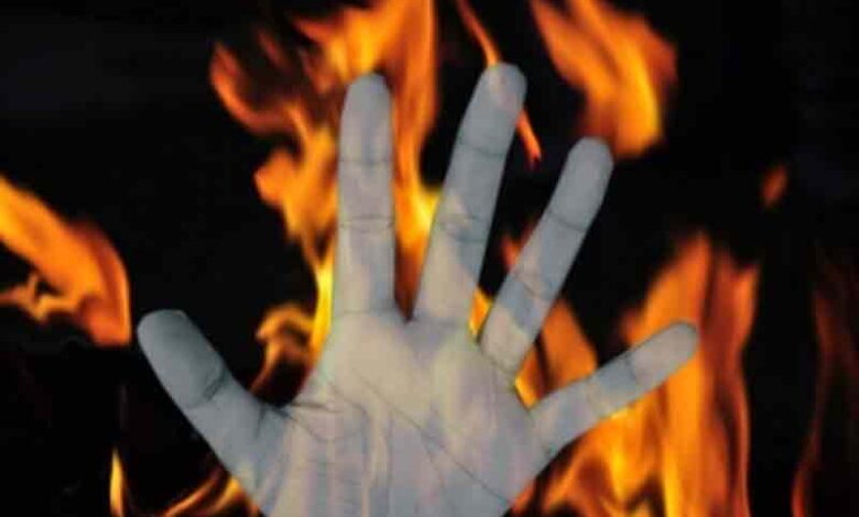 ACCIDENTAL FIRE Five of a family killed in fire in UP’s Bareilly