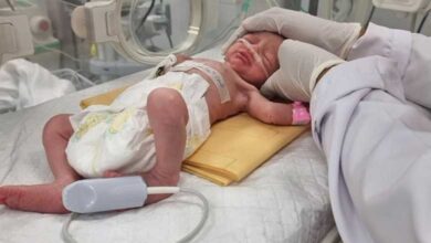 A Palestinian baby in Gaza is born an orphan in an urgent cesarean section after an Israeli strike