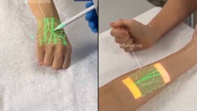 Anand Mahindra shares video of new tech detecting veins using infrared light: Video