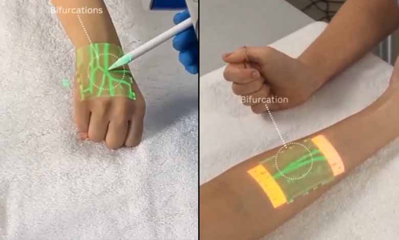 Anand Mahindra shares video of new tech detecting veins using infrared light: Video