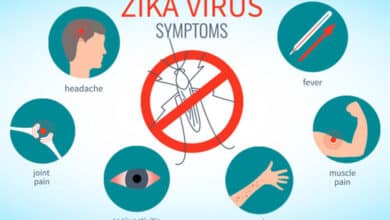 Awareness on Zika Virus During Pregnancy