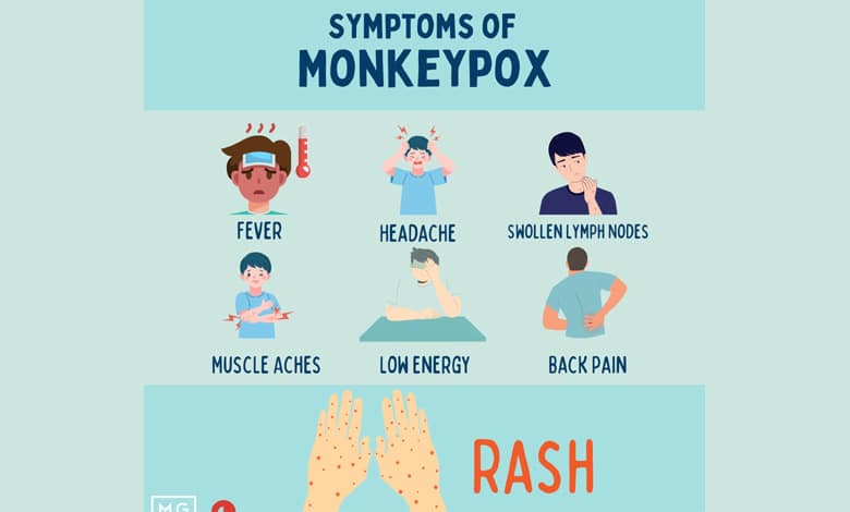 MPOX SYMPTOMPS Mpox Virus Declared Global Health Emergency: Symptoms, Prevention, and Treatment You Need to Know