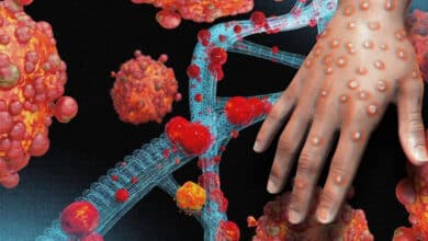 Mpox Virus Declared Global Health Emergency | All You Need to Know as the World Faces Another Crisis