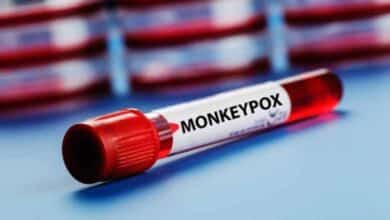 Centre advises states to screen, test all suspect mpox cases