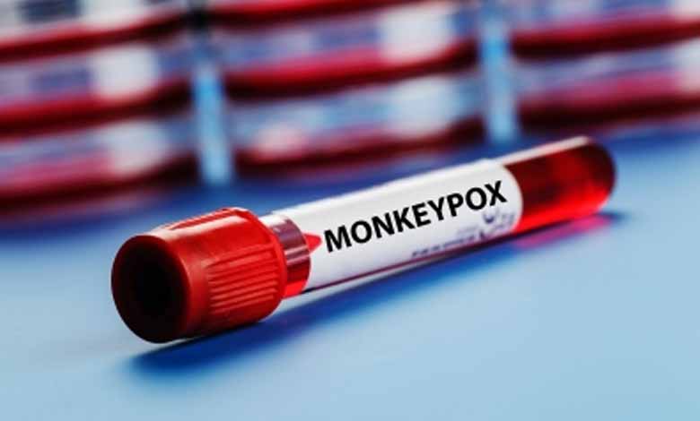 Centre advises states to screen, test all suspect mpox cases