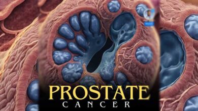 Prostate cancer: A curable ailment that causes social stigma