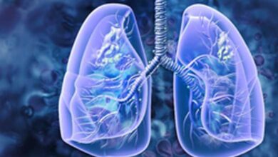 Patients with existing lung problems are more susceptible to lung cancer, warns study