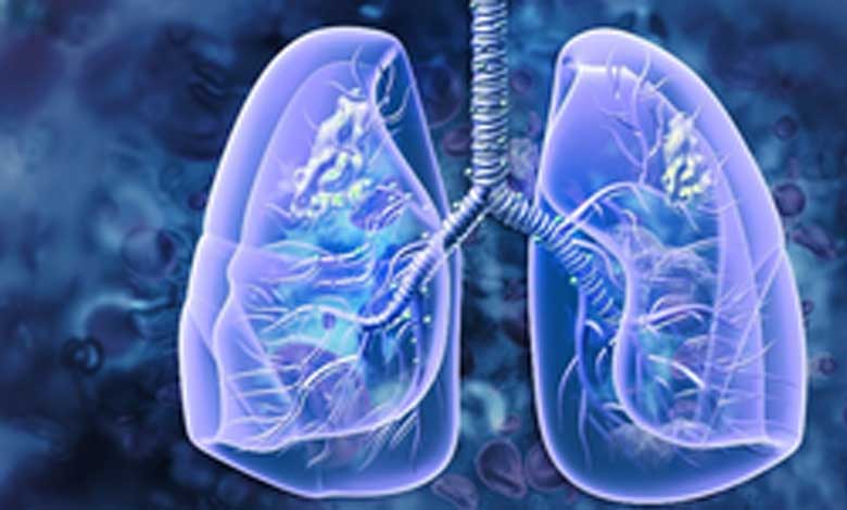 Patients with existing lung problems are more susceptible to lung cancer, warns study