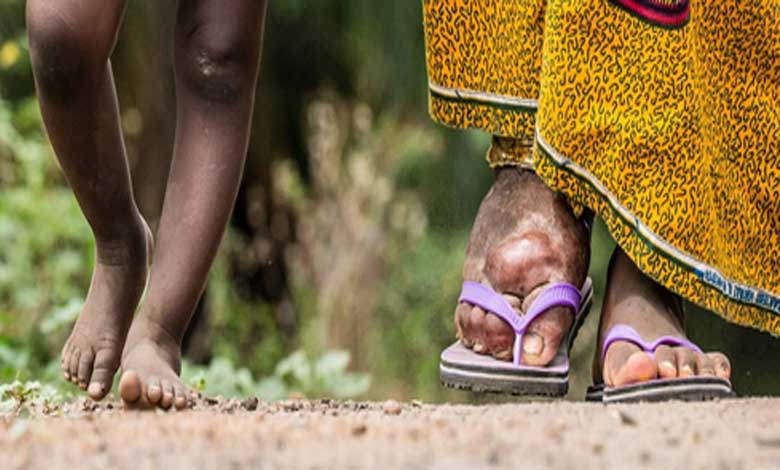 How India is fighting against lymphatic filariasis